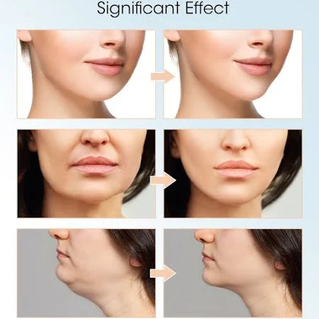 V-Shaped Face Lifting Device – Vibrating EMS Skin Firming & Anti-Aging Tool